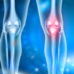 reduce arthritis pain